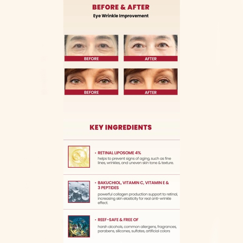 ksecret-seoul-1988-eye-cream-retinal-liposome-4-fermented-bean-30ml-5.jpg